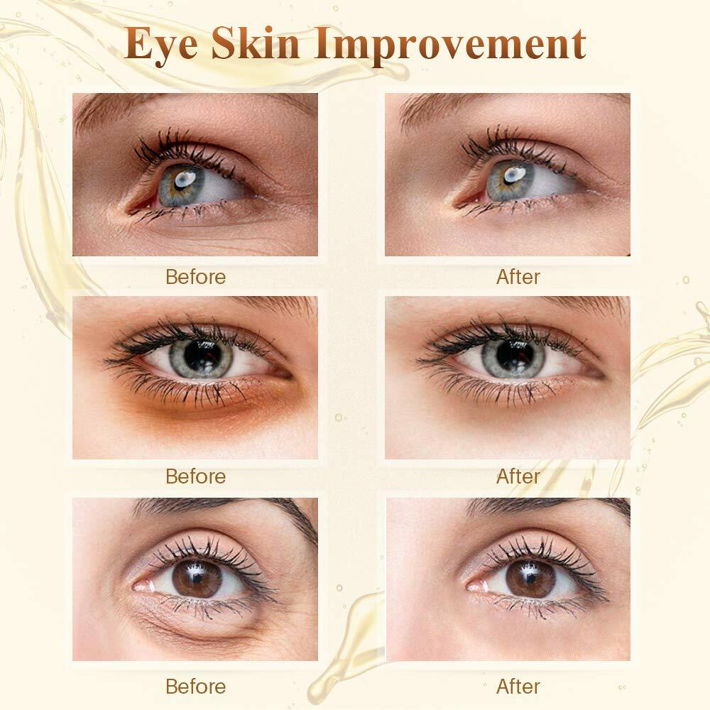 80pc 24K Gold Crystal Collagen Eye Mask Patch Gel Wrinkle Anti Aging Dark Circle