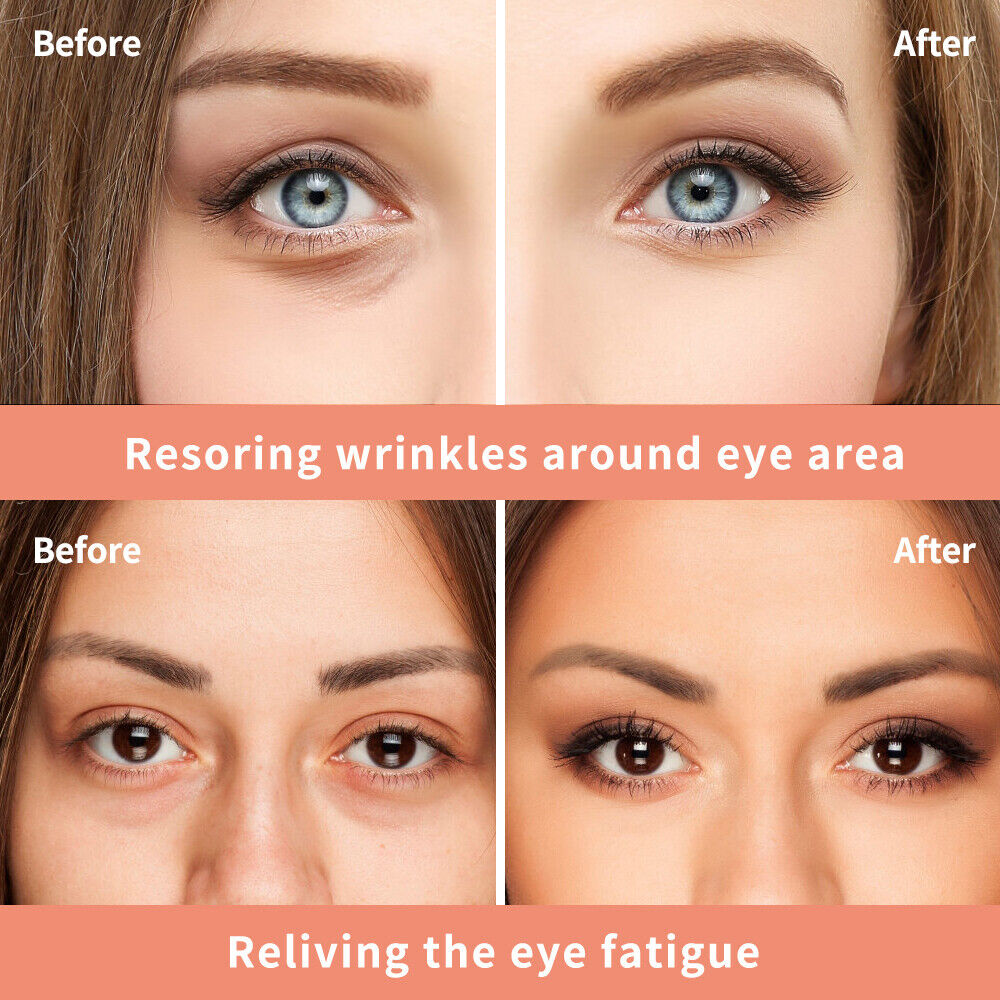VIBRANT GLAMOUR Magic Anti-age Eye Cream Cayman Eye Cream Eye Serum Wrinkle