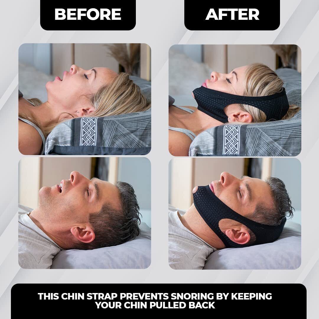 Anti Snoring Chin Strap Sleep Apnea Snore Stop Belt Snoreless Sleep Jaw Solution